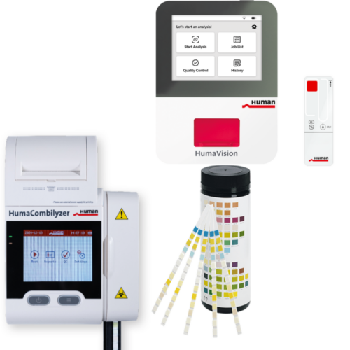 urinalysis e1765747548616